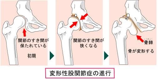 フットボール