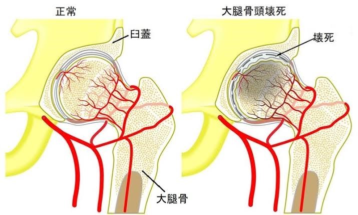 フットボール